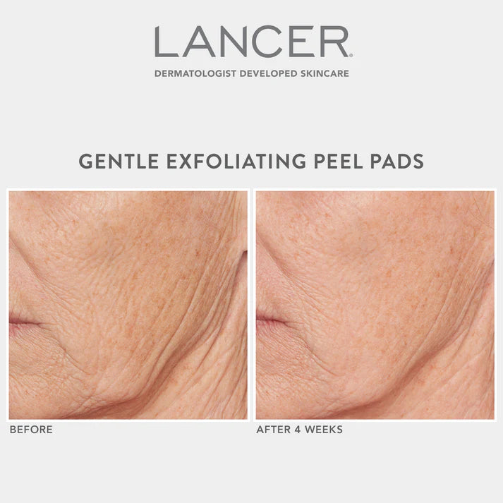 Gentle Exfoliating Peel Pads*