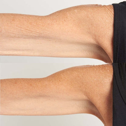 High Potency Hyalurionic Intensive Body Therapy*